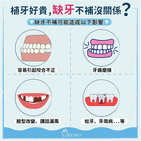 掉牙齒|缺牙不補，牙齒會歪掉嗎？缺牙可以做牙橋、植牙、假。